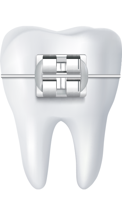 Lý do chọn Up Dental